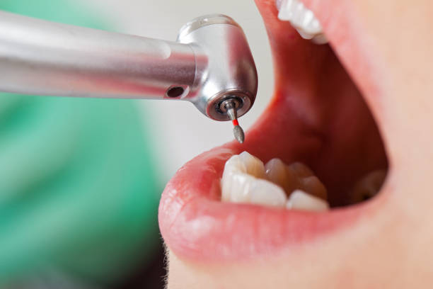 Best Weekend Emergency Dentist in Burlington, NC